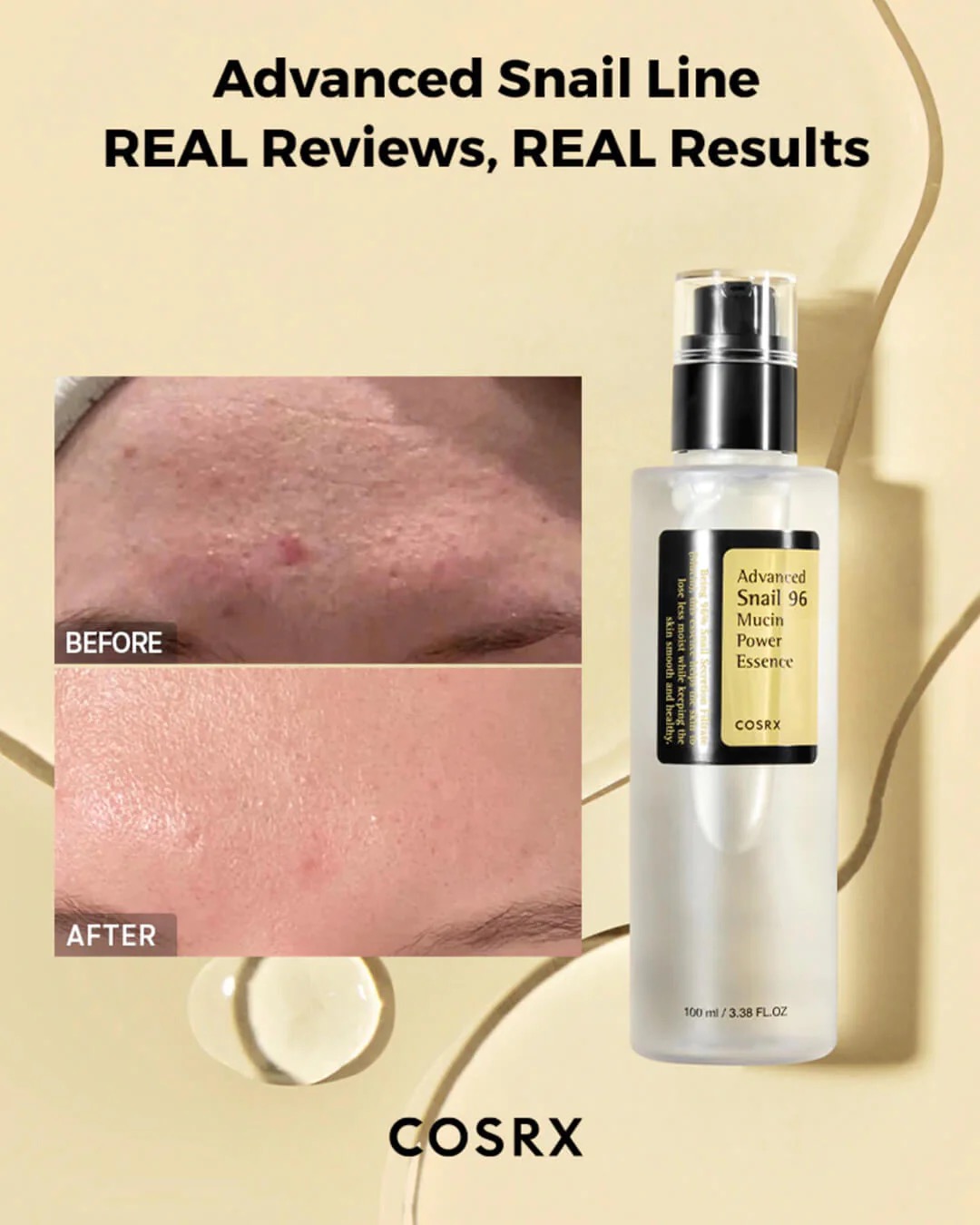 اسنس حلزون کوزارکس Advanced Snail 96 Mucin Power Essence | COSRX - Image 2